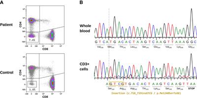 Detection and evolutionary dynamics of somatic FAS variants in autoimmune lymphoproliferative syndrome: Diagnostic implications